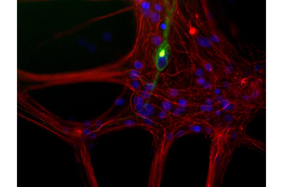Immunofluorescence - Anti-Peripherin Antibody [7C5] (A85432) - Antibodies.com