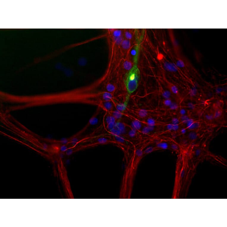 Immunofluorescence - Anti-Peripherin Antibody [7C5] (A85432) - Antibodies.com