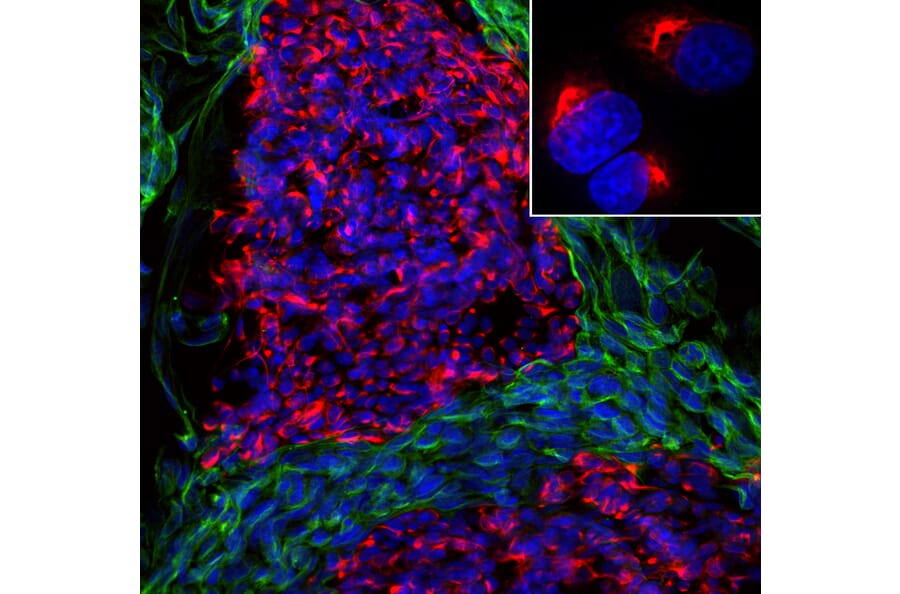Immunofluorescence - Anti-Peripherin Antibody [7C5] (A85432) - Antibodies.com