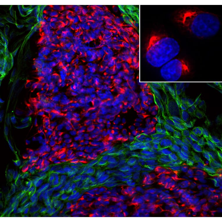 Immunofluorescence - Anti-Peripherin Antibody [7C5] (A85432) - Antibodies.com