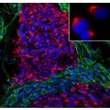 Immunofluorescence - Anti-Peripherin Antibody [7C5] (A85432) - Antibodies.com