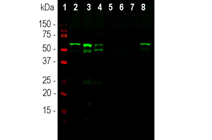 Western Blot - Anti-Peripherin Antibody [7C5] (A85432) - Antibodies.com