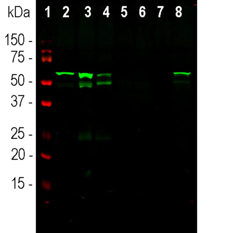Western Blot - Anti-Peripherin Antibody [7C5] (A85432) - Antibodies.com