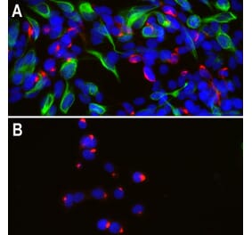 Immunofluorescence - Anti-Peripherin Antibody (A85433) - Antibodies.com
