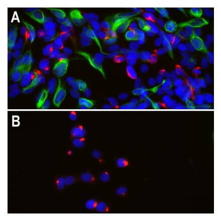 Immunofluorescence - Anti-Peripherin Antibody (A85433) - Antibodies.com