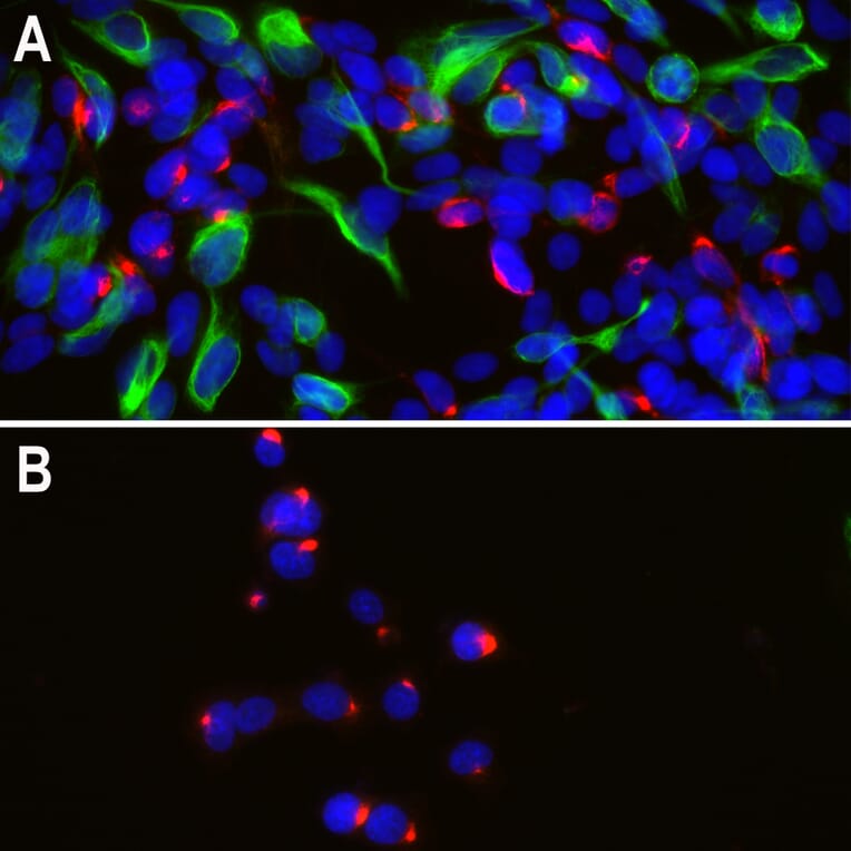 Immunofluorescence - Anti-Peripherin Antibody [8G2] (A85433) - Antibodies.com