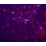 Immunofluorescence - Anti-Peripherin Antibody [8G2] (A85433) - Antibodies.com