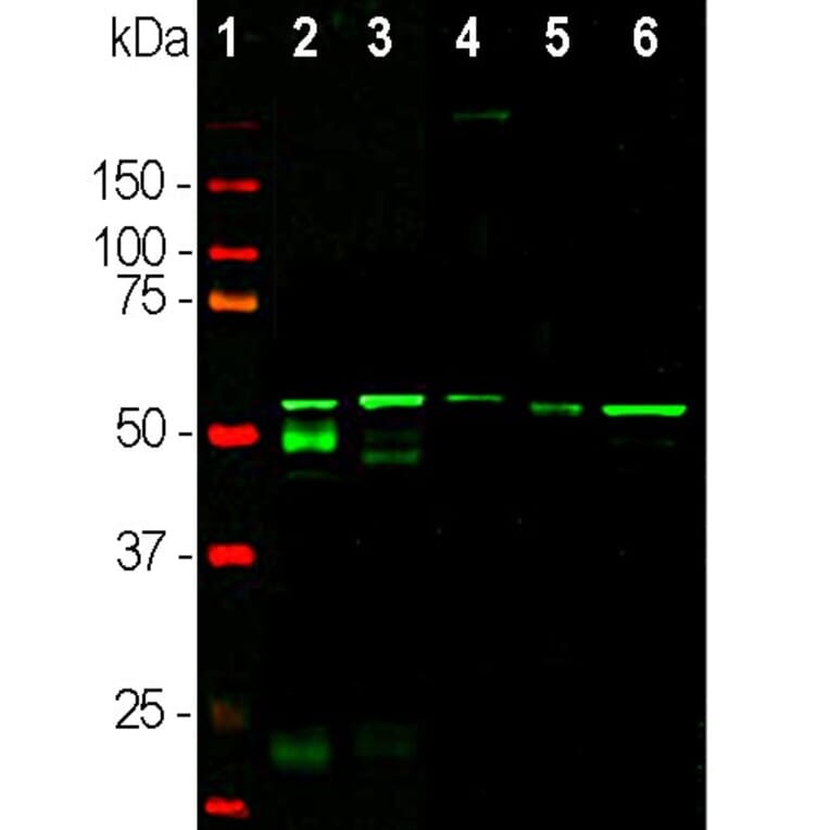 Western Blot - Anti-Peripherin Antibody [8G2] (A85433) - Antibodies.com