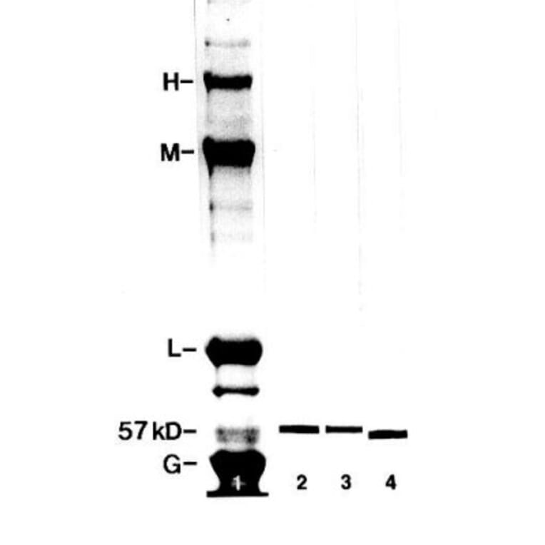 Western Blot - Anti-Peripherin Antibody [8G2] (A85433) - Antibodies.com