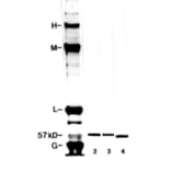 Western Blot - Anti-Peripherin Antibody [8G2] (A85433) - Antibodies.com