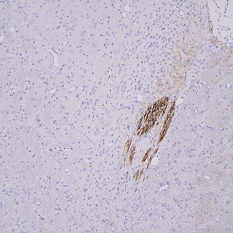Immunohistochemistry - Anti-Peripherin Antibody [8G2] (A85433) - Antibodies.com