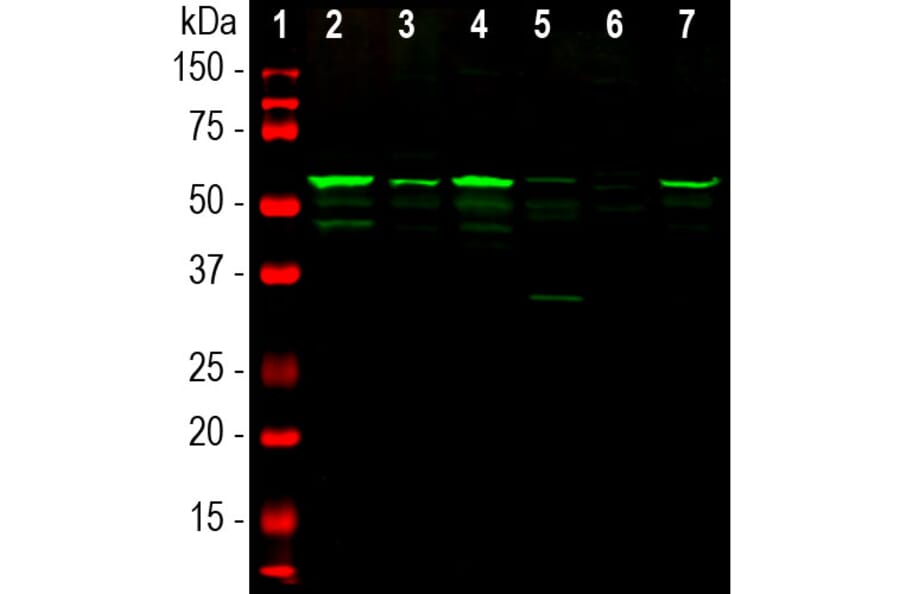 Western Blot - Anti-Peripherin Antibody (A85435) - Antibodies.com