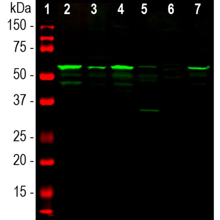 Western Blot - Anti-Peripherin Antibody (A85435) - Antibodies.com