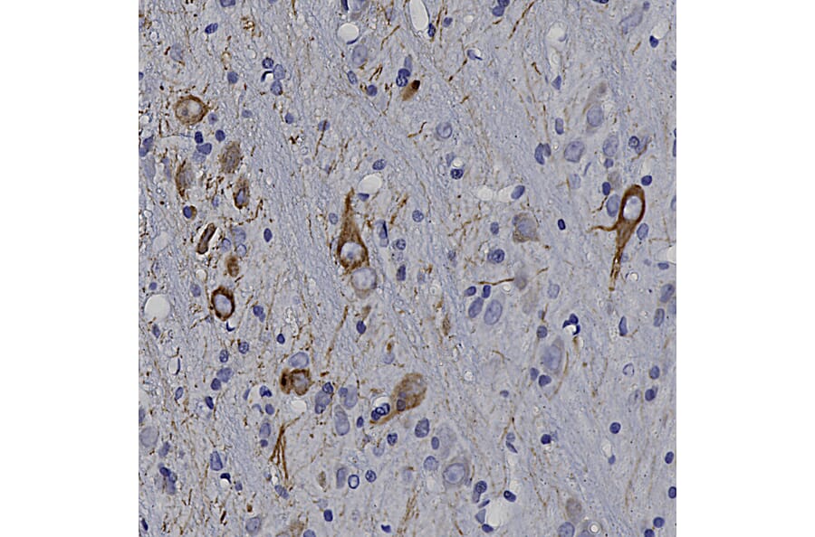 Immunohistochemistry - Anti-Peripherin Antibody (A85435) - Antibodies.com