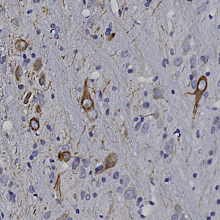 Immunohistochemistry - Anti-Peripherin Antibody (A85435) - Antibodies.com