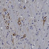 Immunohistochemistry - Anti-Peripherin Antibody (A85435) - Antibodies.com