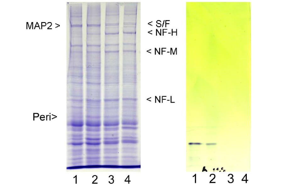 Western Blot - Anti-Peripherin Antibody (A85435) - Antibodies.com