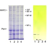 Western Blot - Anti-Peripherin Antibody (A85435) - Antibodies.com