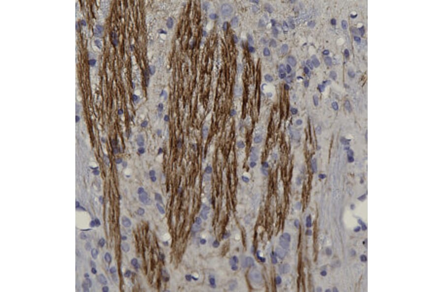 Immunohistochemistry - Anti-Peripherin Antibody (A85435) - Antibodies.com