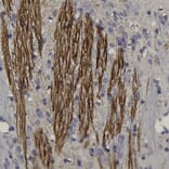 Immunohistochemistry - Anti-Peripherin Antibody (A85435) - Antibodies.com