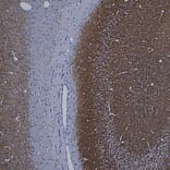 Immunohistochemistry - Anti-HSP60 Antibody [1C7] (A85439) - Antibodies.com