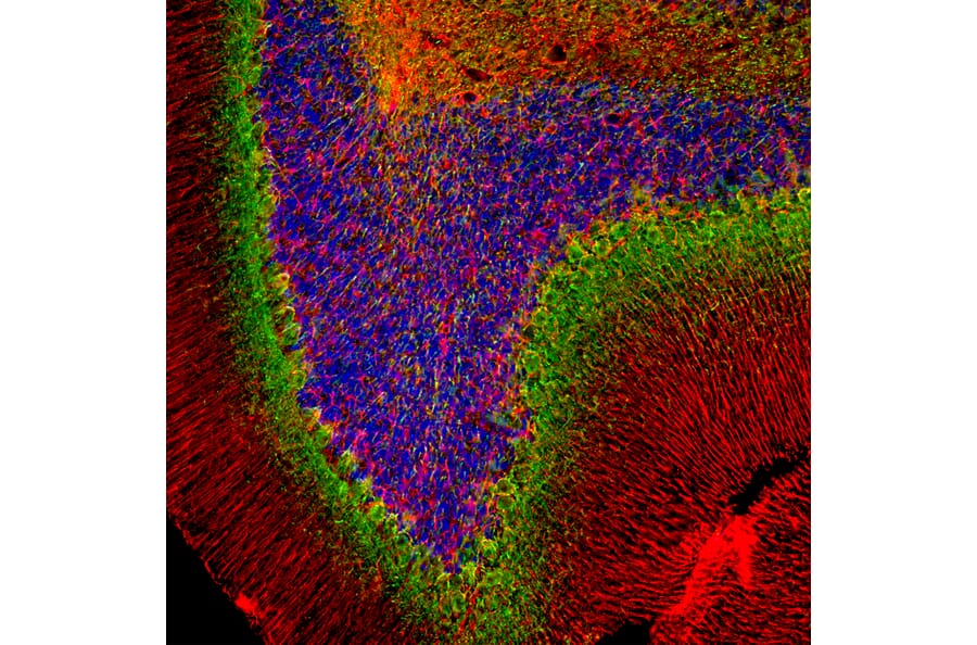 Immunofluorescence - Anti-alpha Internexin Antibody (A85441) - Antibodies.com