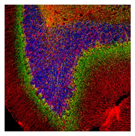 Immunofluorescence - Anti-Alpha-Internexin Antibody (A85441) - Antibodies.com