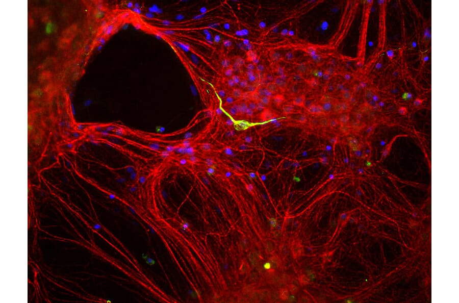 Immunofluorescence - Anti-alpha Internexin Antibody (A85441) - Antibodies.com