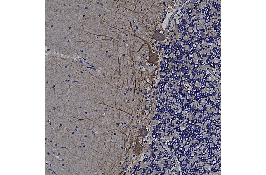 Immunohistochemistry - Anti-alpha Internexin Antibody (A85441) - Antibodies.com