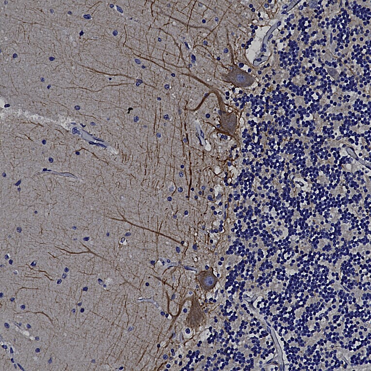 Immunohistochemistry - Anti-alpha Internexin Antibody (A85441) - Antibodies.com