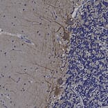 Immunohistochemistry - Anti-alpha Internexin Antibody (A85441) - Antibodies.com