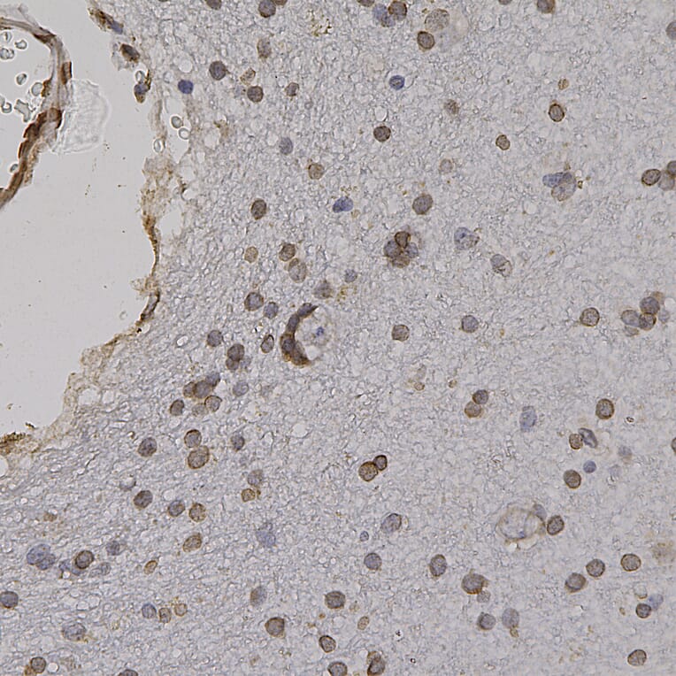 Immunohistochemistry - Anti-Lamin A + Lamin C Antibody (A85443) - Antibodies.com