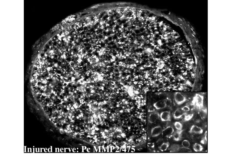 Immunohistochemistry - Anti-MMP2 Antibody (A85445) - Antibodies.com