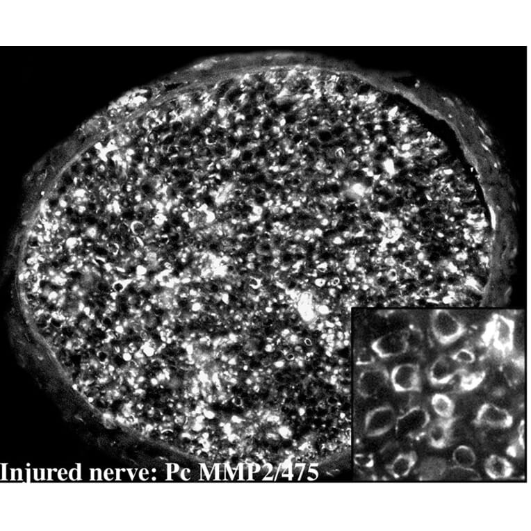 Immunohistochemistry - Anti-MMP2 Antibody (A85445) - Antibodies.com