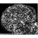 Immunohistochemistry - Anti-MMP2 Antibody (A85445) - Antibodies.com