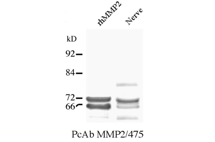 Western Blot - Anti-MMP2 Antibody (A85445) - Antibodies.com