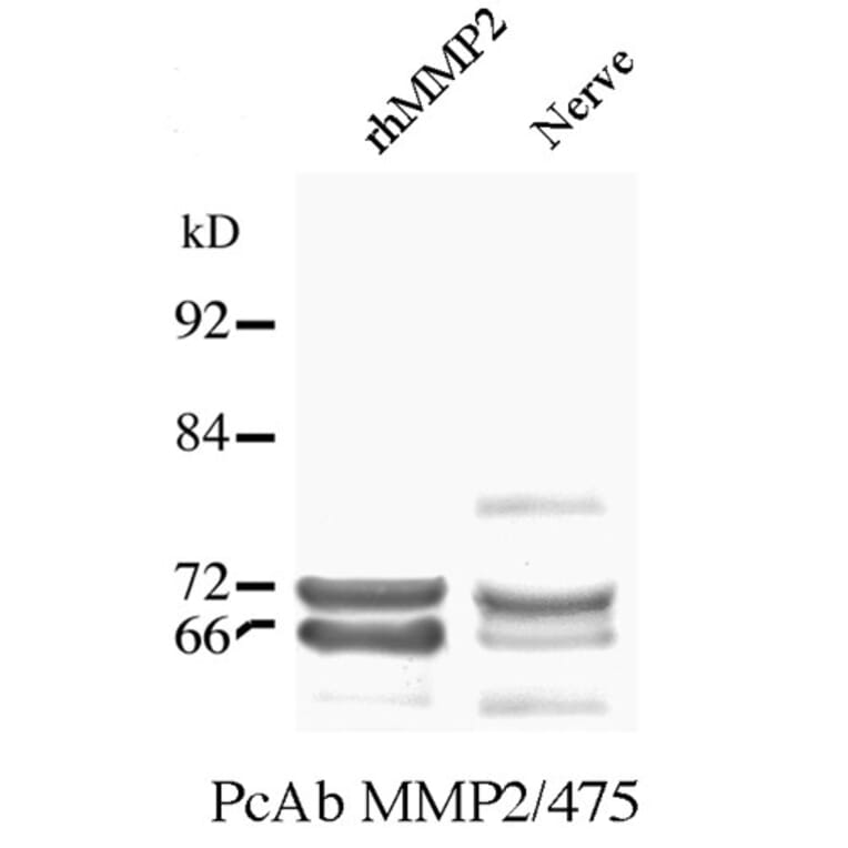 Western Blot - Anti-MMP2 Antibody (A85445) - Antibodies.com