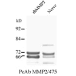 Western Blot - Anti-MMP2 Antibody (A85445) - Antibodies.com