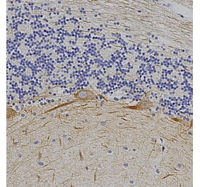 Immunohistochemistry - Anti-alpha Internexin Antibody (A85446) - Antibodies.com