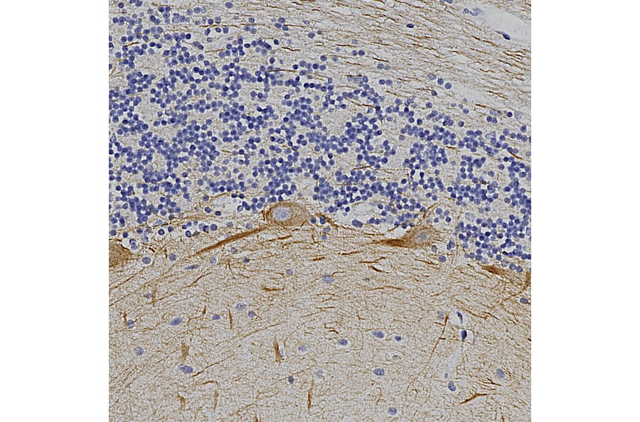 Immunohistochemistry - Anti-alpha Internexin Antibody (A85446) - Antibodies.com