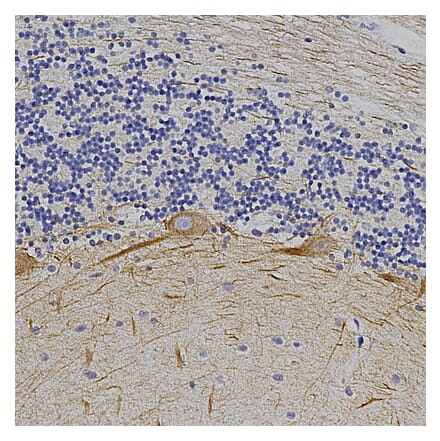 Immunohistochemistry - Anti-alpha Internexin Antibody (A85446) - Antibodies.com