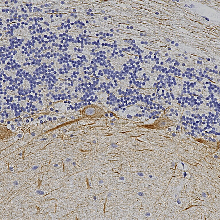 Immunohistochemistry - Anti-alpha Internexin Antibody (A85446) - Antibodies.com
