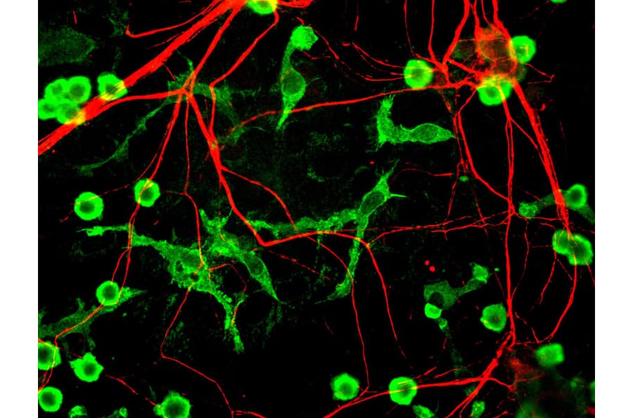 Immunofluorescence - Anti-alpha Internexin Antibody (A85446) - Antibodies.com