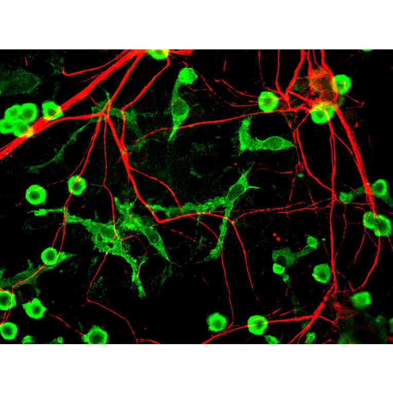 Immunofluorescence - Anti-Alpha-Internexin Antibody (A85446) - Antibodies.com