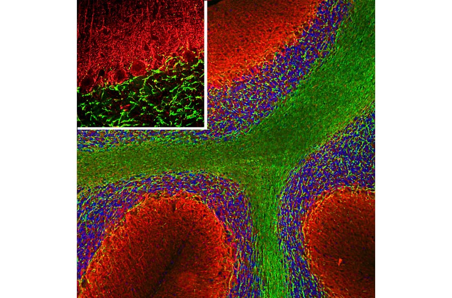Immunofluorescence - Anti-alpha Internexin Antibody (A85446) - Antibodies.com