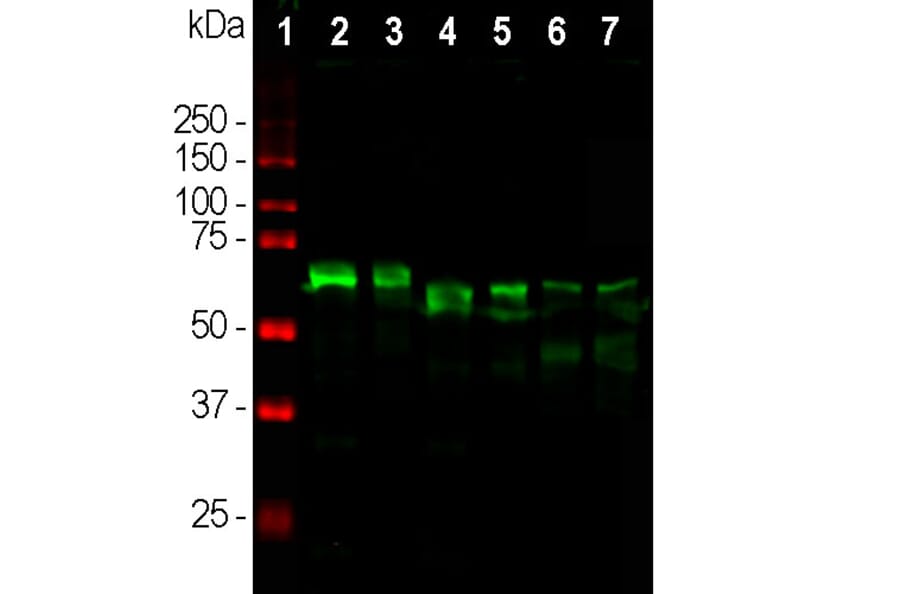 Western Blot - Anti-alpha Internexin Antibody (A85446) - Antibodies.com