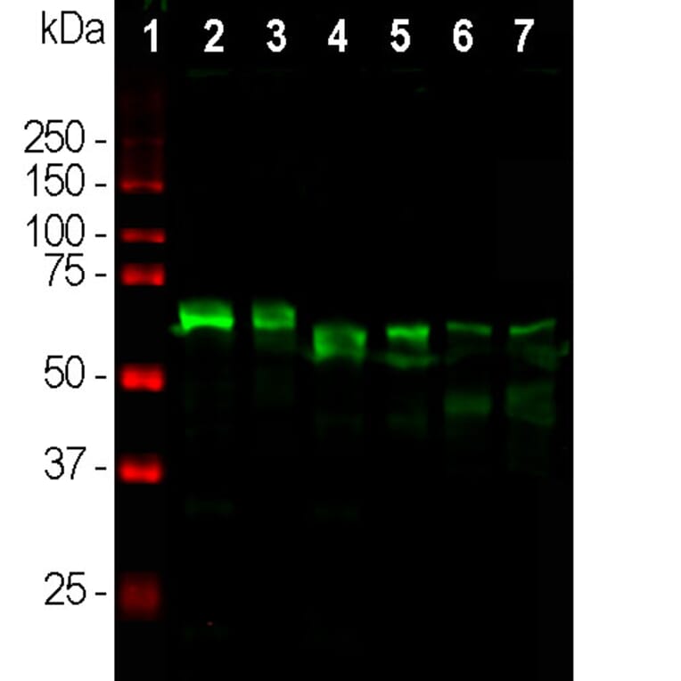 Western Blot - Anti-alpha Internexin Antibody (A85446) - Antibodies.com