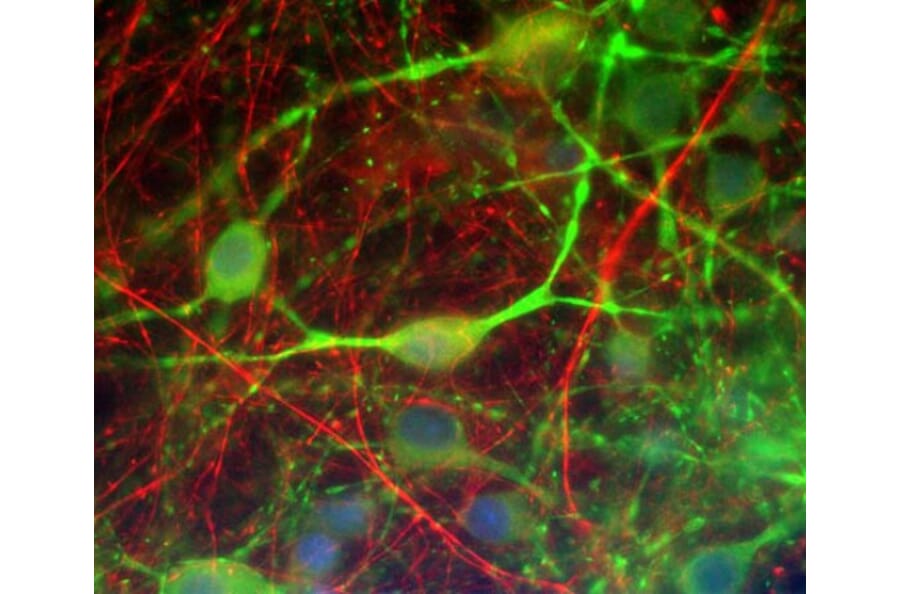 Immunofluorescence - Anti-alpha Internexin Antibody [1D2] (A85447) - Antibodies.com