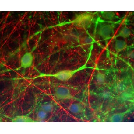 Immunofluorescence - Anti-alpha Internexin Antibody [1D2] (A85447) - Antibodies.com