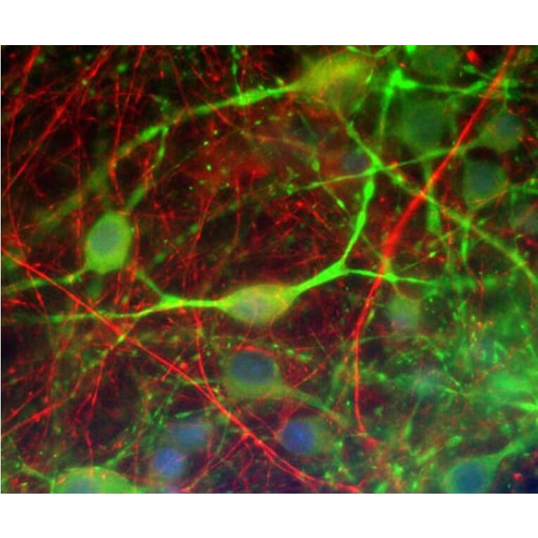 Immunofluorescence - Anti-alpha Internexin Antibody [1D2] (A85447) - Antibodies.com